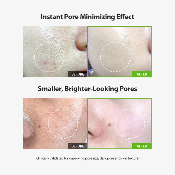 Sungboon Editor Green Tomato Pore Lifting Ampoule+ 1.01 oz