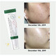 Results of AXIS-Y Dark Spot Correcting Glow Serum 1.69 oz