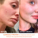 Before and after about Dr. Dennis Gross Alpha Beta Extra Strength Daily Peel 1 Pack