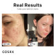 Before and after about CosRX Niacinamide 15% Face Serum 0.67 oz