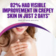 92% Had Visible Improvement in Crepey Skin in just 2 Days