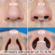 Before and After about Mack's AIRMAX Nasal Dilator Small Clear for Better Sleep