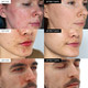 Results of IVOSKIN Intensive Cica Repair Cream