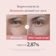 Results of using Medicube Pink Peptide Eye Serum