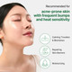 Soothing toner with mugwort and centella asiatica