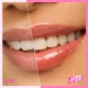 Hydrating glossy lip treatment SKINTIFIC