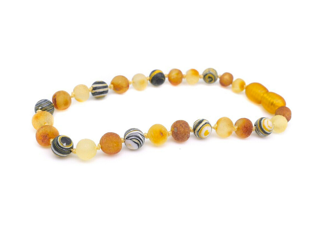 Adult amber bracelet with matte natural yellow malachite gemstone beads