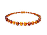 Adult amber anklet cognac baroque beads