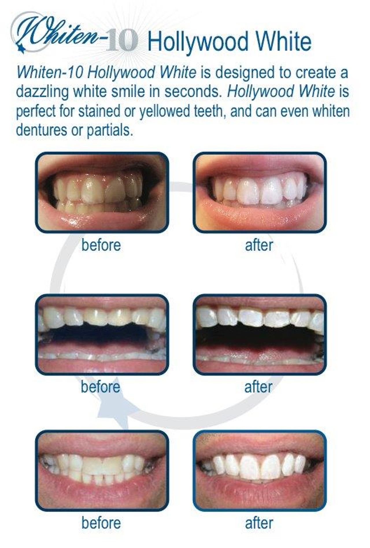 TOUCH UP WHITEN 10 whitener white liquid paint ivory white fake tooth