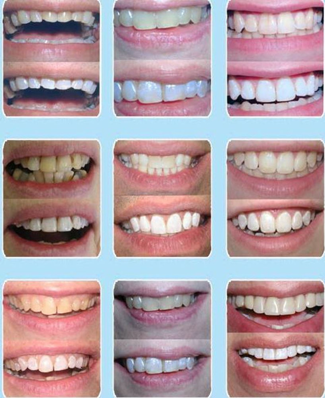 set Hollywood White + Touch Up whiten 10 whitener liquid paint fake