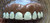 Billy Bob Hillbilly Kit Includes Hat & Teeth Halloween Costume Set Billy Bob Hillbilly Kit Includes Hat & Teeth Halloween Costume Set