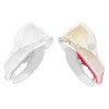 Norah – REPLACEMENT – Left Maxilla