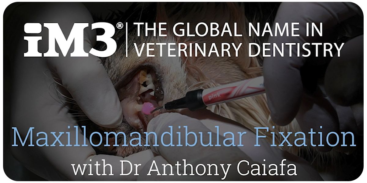 Maxillomandibular Fixation