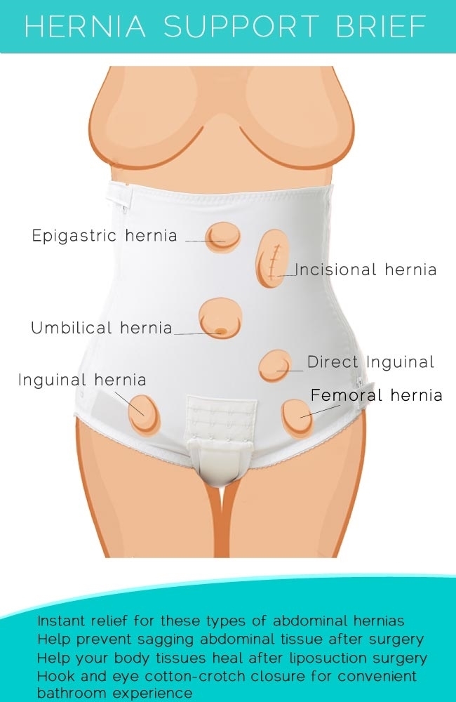 0002003-womens-abdominal-hernia-brief.jpeg
