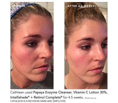 revision skincare brightening facial wash