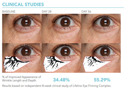 lifeline firming eye complex
