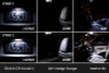Diode Dynamics 11-23 Dodge Charger Interior LED Kit Cool White Stage 2