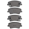 R1 17-22 Hyundai Elantra Front R1 Optimum OE Brake Pads