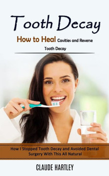 Tooth Decay: How To Heal Cavities And Reverse Tooth Decay (How I Stopped Tooth Decay And Avoided Dental Surgery With This All Natural) - 9781998038169 Tooth Decay: How To Heal Cavities And Reverse Tooth Decay (How I Stopped Tooth Decay And Avoided Dental Surgery With This All Natural) - 9781998038169