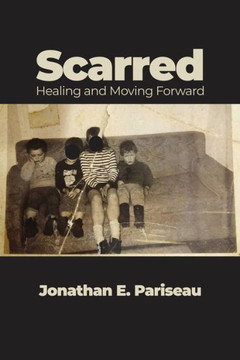 Scarred: Healing and Moving Forward