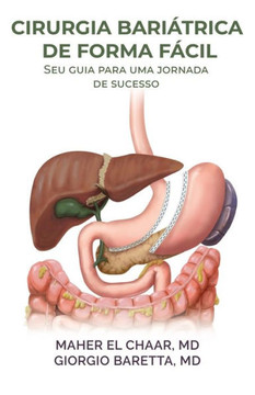Cirurgia Bari?rica De Forma F?il: Seu guia para uma jornada de sucesso