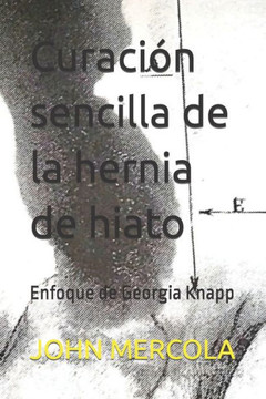 Curaci? sencilla de la hernia de hiato: Enfoque de Georgia Knapp
