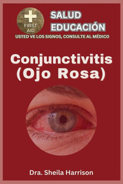 Ojo rosa (conjuntivitis): Tipos, S?tomas, Causas, Diagn?tico, Tratamiento, Medicamentos, Prevenci? y Control, Manejo