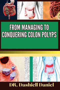 From Managing to Conquering Colon Polyps: Expert Guide To Colon Polyps Causes, Symptoms, Treatment, And Achieving Complete Wellness From Managing to Conquering Colon Polyps: Expert Guide To Colon Polyps Causes, Symptoms, Treatment, And Achieving Complete Wellness