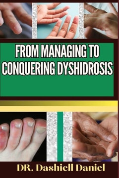 From Managing to Conquering Dyshidrosis: Expert Guide To Understanding the Causes, Recognizing Symptoms, Prevention and Embracing Effective Treatments From Managing to Conquering Dyshidrosis: Expert Guide To Understanding the Causes, Recognizing Symptoms, Prevention and Embracing Effective Treatments