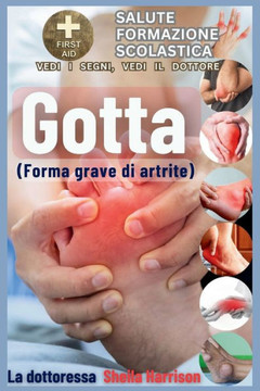 Gotta: forma grave di artrite: Cause, sintomi, gestione dei modificatori del rischio, trattamento, farmaci, prevenzione, alim