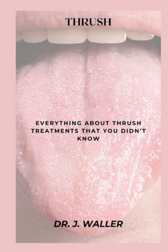 Thrush: Everything about Thrush Treatments That You Didn't Know