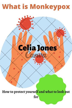 What Is Monkeypox: How to protect yourself and what to look out for. Guidelines for safety