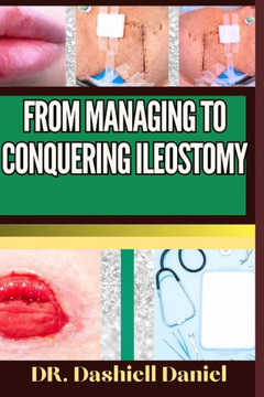 From Managing to Conquering Ileostomy: Expert Guide To Understanding the Causes, Recognizing Symptoms, Prevention and Embracing Effective Treatments f From Managing to Conquering Ileostomy: Expert Guide To Understanding the Causes, Recognizing Symptoms, Prevention and Embracing Effective Treatments f