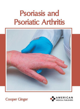 Psoriasis and Psoriatic Arthritis Psoriasis and Psoriatic Arthritis