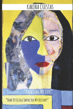 "" Painting My Life"" "" How Vitiligo Impacted my history.""