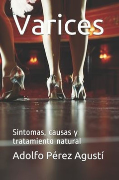 Varices: Síntomas, causas y tratamiento natural