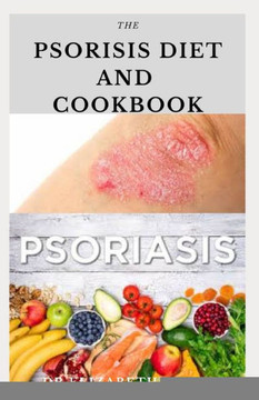 The Psoriasis Diet and Cookbook: Dietary Guide For Preventing and Healing Psoriasis: Includes Delicious Recipe, Meal Plan and Cookbook