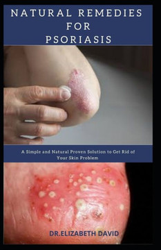 Natural Remedies for Psoriasis: A Simple and Natural Proven Solution to Get Rid of Your Skin Problem: Dermatitis, Eczema, Psoriasis & Rosacea and Othe