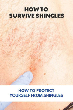 How To Survive Shingles: How To Protect Yourself From Shingles: How To Speed Up Shingles Recovery