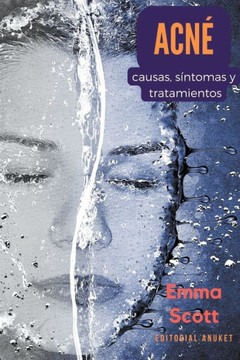 Acné: Causas, Síntomas y Tratamientos