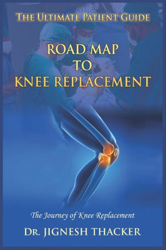 Road Map to Knee Replacement: The Journey Of Knee Replacement, Ultimate Patient Guide