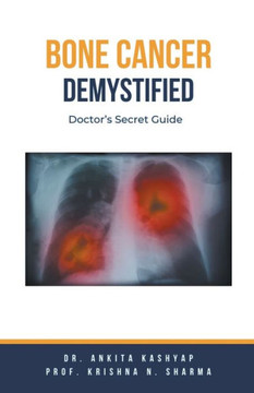 Bone Cancer Demystified: Doctor's Secret Guide