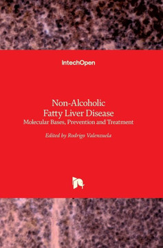 Non-Alcoholic Fatty Liver Disease: Molecular Bases, Prevention and Treatment