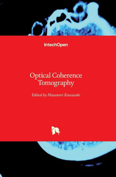 Optical Coherence Tomography Optical Coherence Tomography