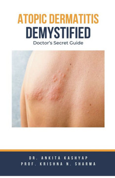 Atopic Dermatitis Demystified: Doctor's Secret Guide