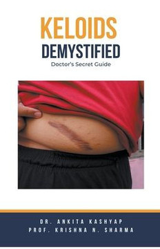 Keloids Demystified: Doctor's Secret Guide
