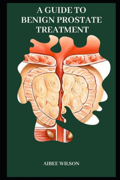 A Guide to Benign Prostate Treatment