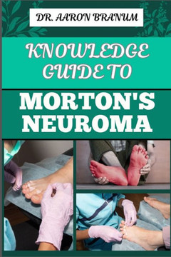 Knowledge Guide to Morton's Neuroma: Essential Manual To Symptoms, Diagnosis, Treatment, And Pain Relief For Foot Health And Nerve Pain Management