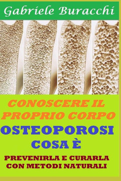 Osteoporosi Cosa È: Prevenirla E Curarla Con Metodi Naturali