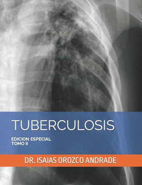 Tuberculosis: Edicion Especial. Tomo II